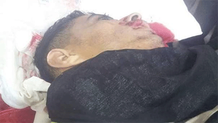 Aumenta a 100 el número de mártires del “Levantamiento de Al Quds”